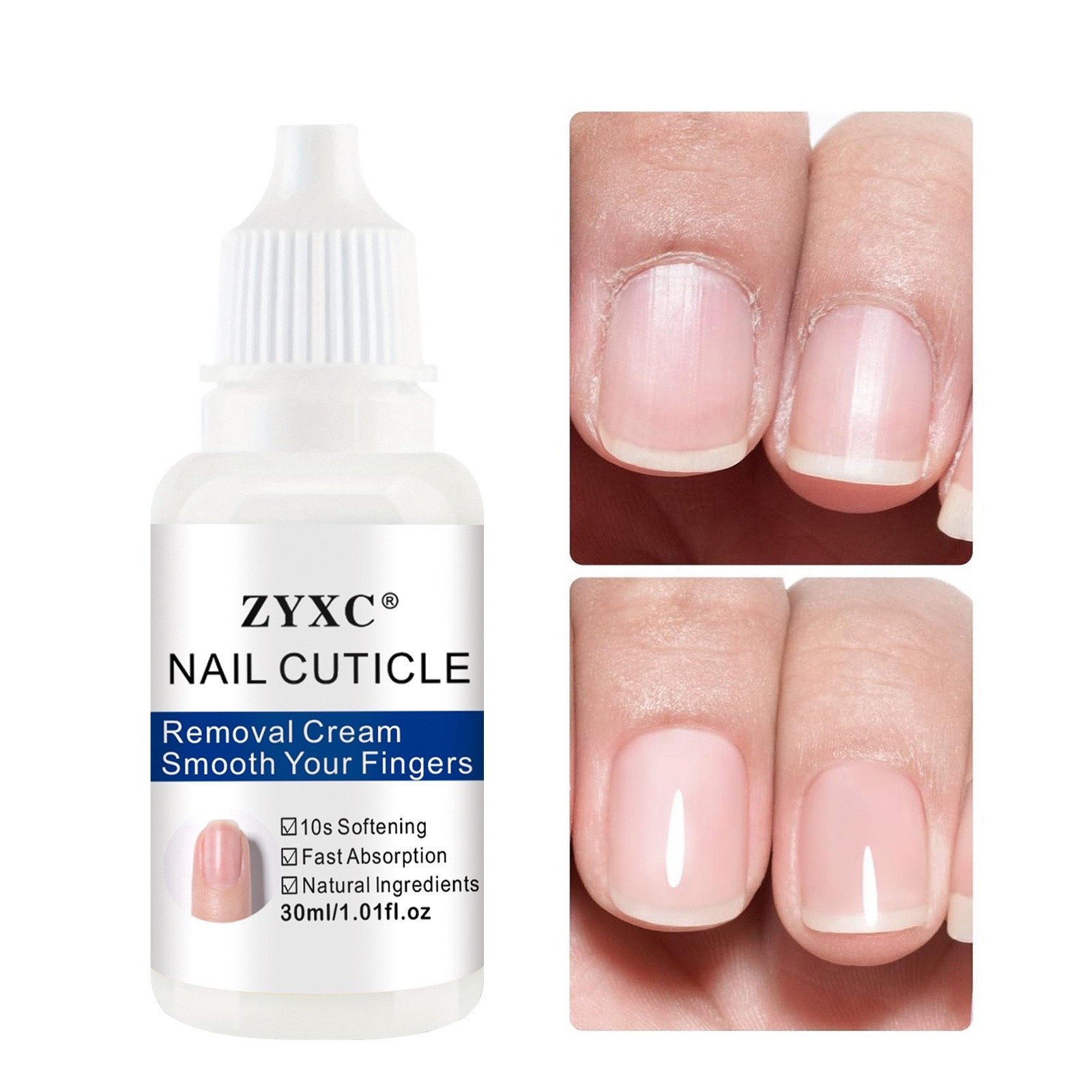 ZYXC Nail Cuticle